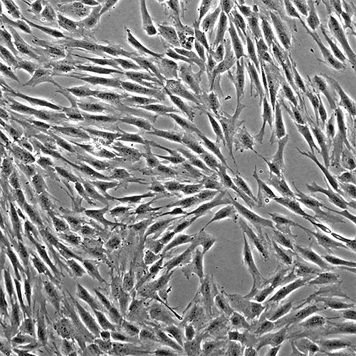 Adult bone-marrow-derived mesenchymal stem cells contribute to wound healing of skin appendages