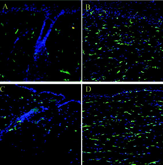 Contribution of bone marrow-derived cells to skin: collagen deposition and wound repair