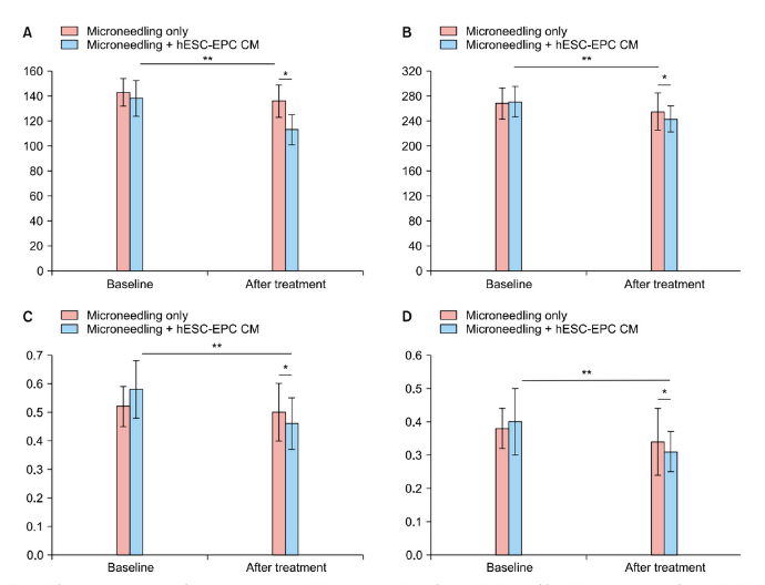 Efficacy of Microneedling Plus Human Stem Cell Conditioned Medium for Skin Rejuvenation