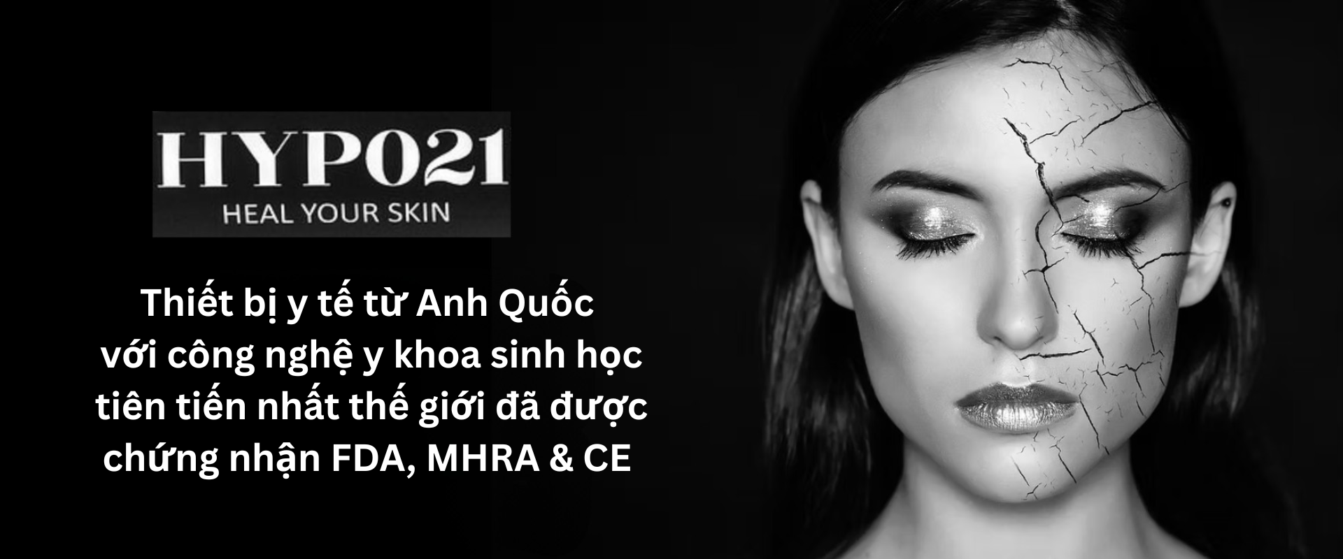 HYPO21_Home_Banner_moi_VN