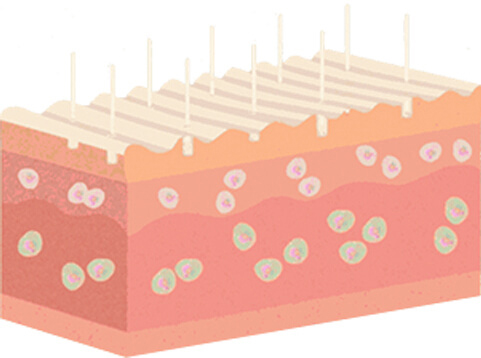 How Does Microchanneling Stimulate Cellular Activity?